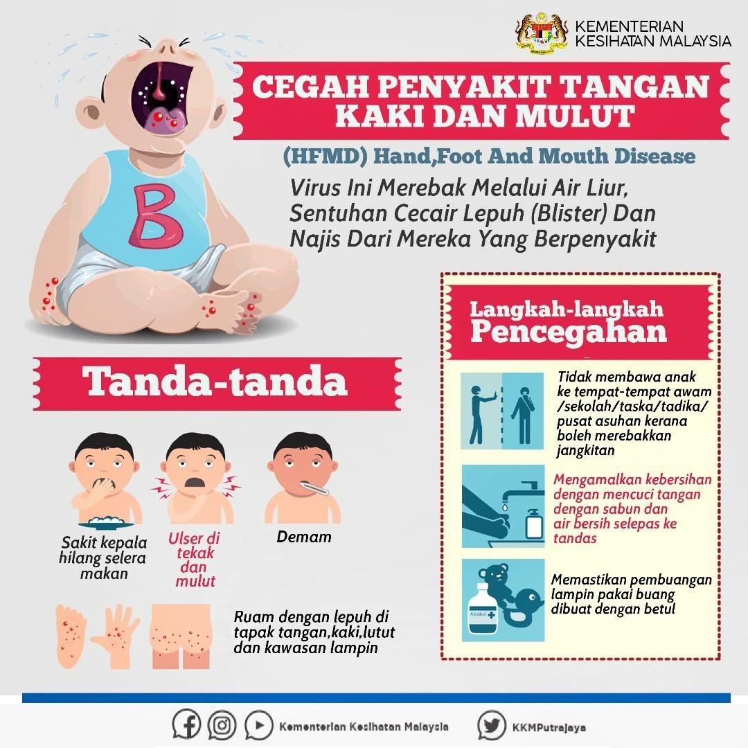 Hand Foot And Mouth Disease Hfmd Official Portal Of Iskandar Puteri City Council Mbip